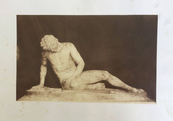 Produktbild Dovizielli. Galate mourant. Capitole Rome. Albumine.