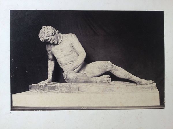 Productafbeelding Galate mourant. Capitole Rome.